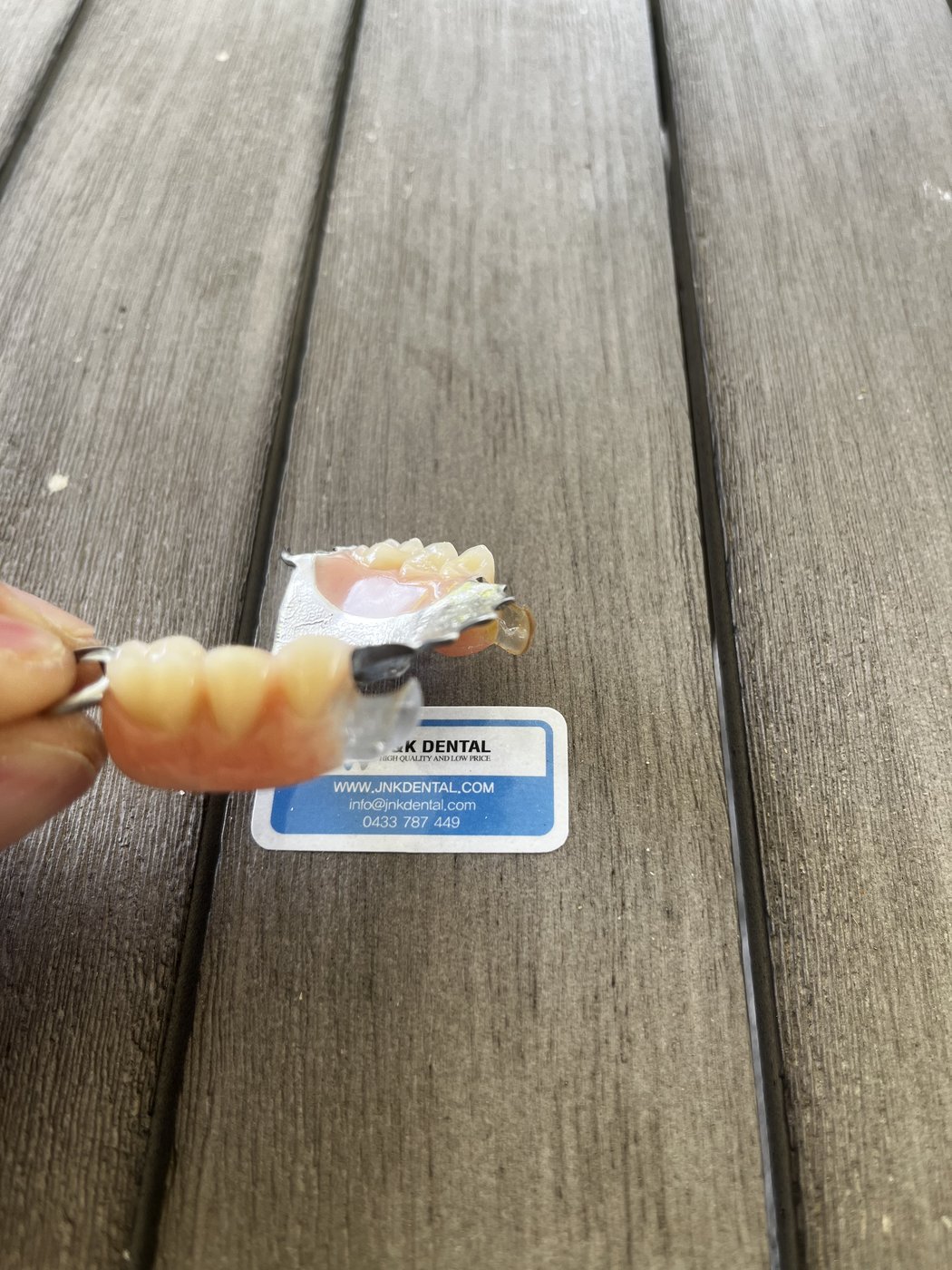 Partial denture with clasp detail